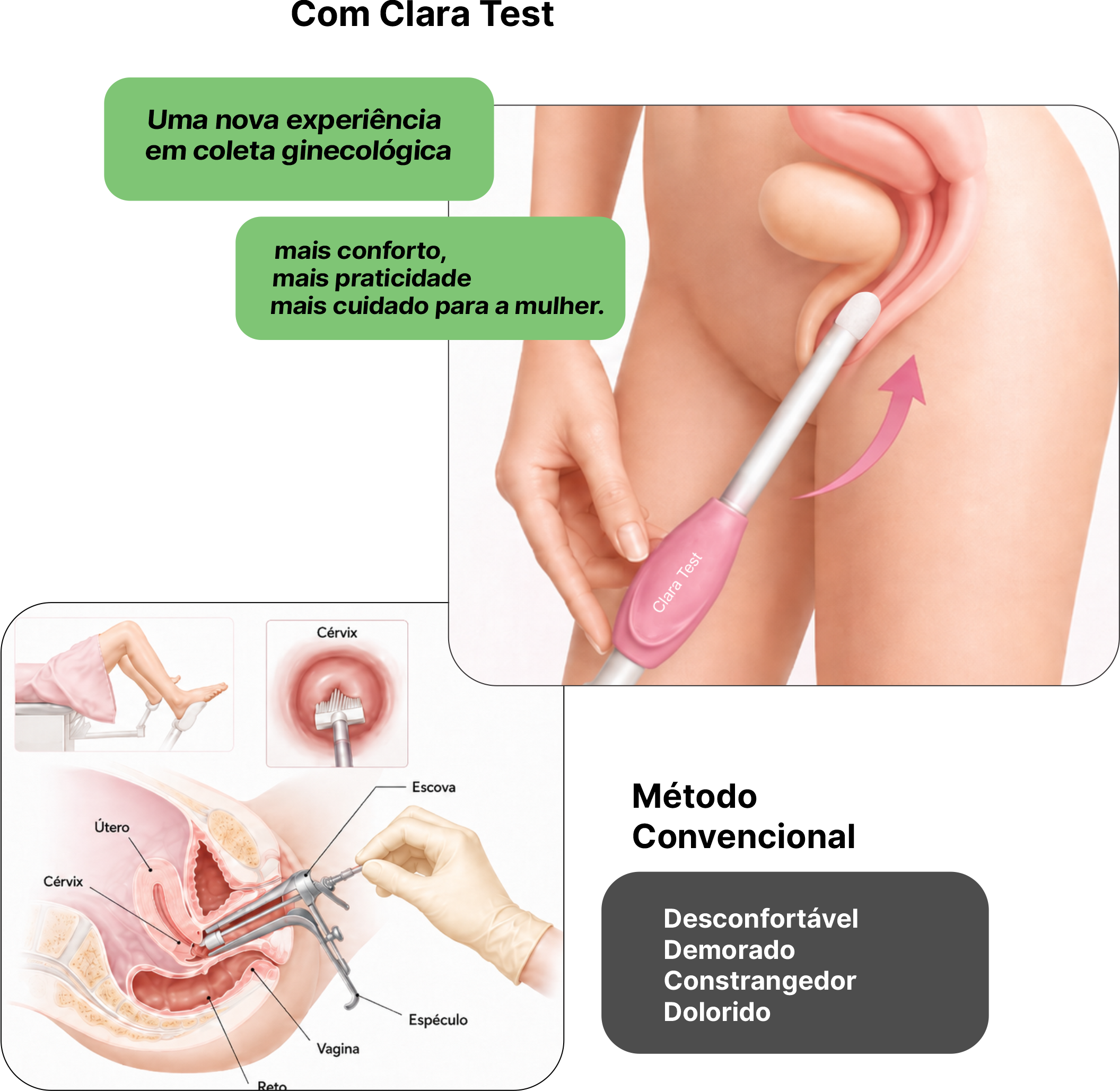 Clara Test